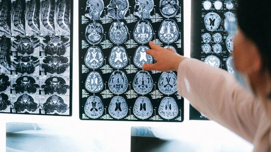 Neuropsycholog – niszowa specjalizacja z dużym potencjałem zarobkowym