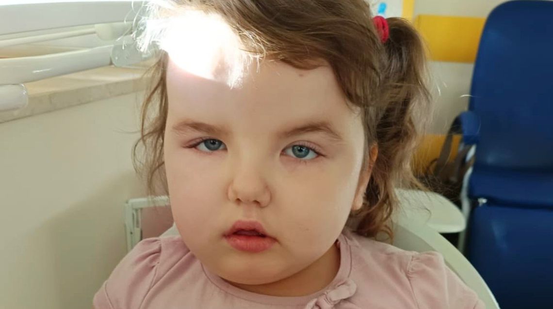 zdjęcie przedstawia twarz 5-letniej dziewczynki